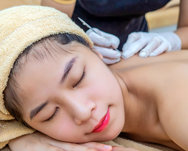 Điều Trị Mụn Lưng Tại Sen Beauty